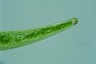 Closterium striolatum