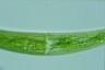 Closterium striolatum