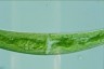 Closterium striolatum