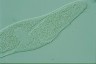 Spirostomum teres