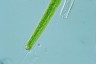 Closterium angustatum