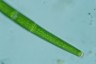 Closterium angustatum