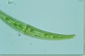 Closterium rostratum