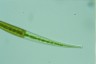 Closterium ralfsii