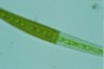 Closterium ralfsii