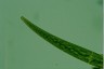 Closterium ralfsii