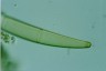 Closterium striolatum