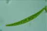 Closterium intermedium