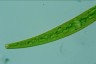 Closterium intermedium