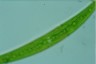 Closterium intermedium