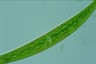 Closterium intermedium