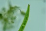 Closterium intermedium