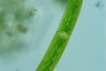 Closterium intermedium