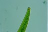 Closterium intermedium