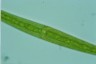 Closterium ralfsii