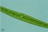 Closterium ralfsii