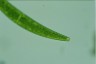 Closterium striolatum