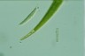 Closterium ralfsii