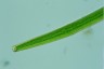 Closterium angustatum