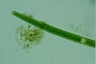 Closterium angustatum