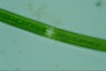 Closterium angustatum