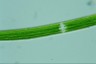 Closterium angustatum