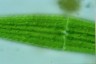 Closterium lunula