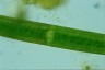 Closterium turgidum