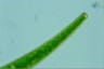 Closterium striolatum