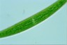 Closterium striolatum