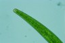 Closterium striolatum