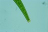 Closterium striolatum