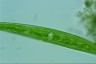 Closterium striolatum