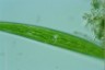 Closterium striolatum