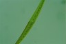 Closterium ralfsii