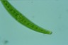 Closterium rostratum