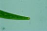 Closterium striolatum