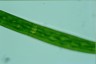 Closterium striolatum