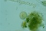 Choanocystis aculeata